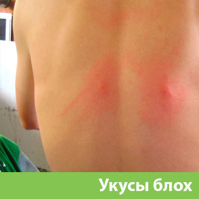 Укусы блох в Дзержинске