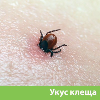 Укус клеща в Дзержинске